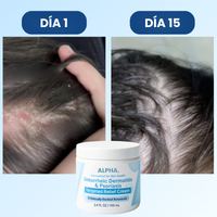 Crema para Dermatitis Seborreica y Psoriasis™