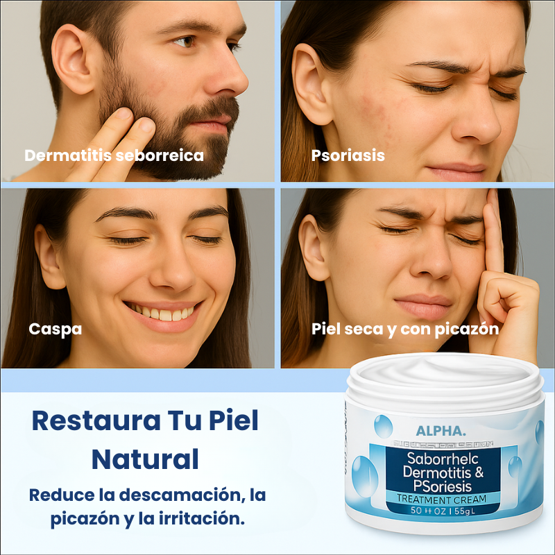 Crema para Dermatitis Seborreica y Psoriasis™
